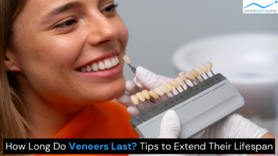 Veneers