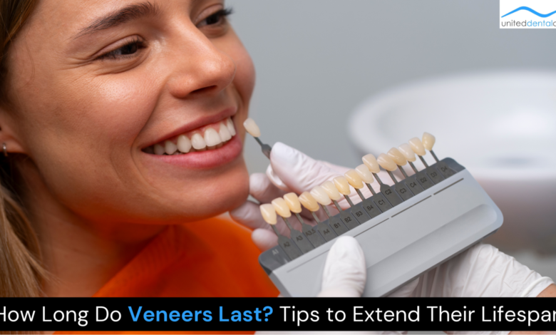 Veneers